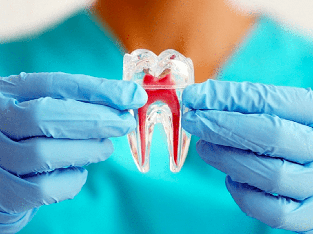 009-endodontia